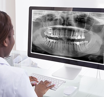 Digital dental x-rays