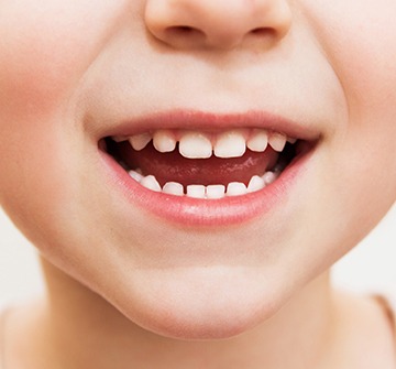 Closeup of child's healthy smile