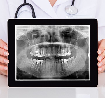 Digital dental x-rays