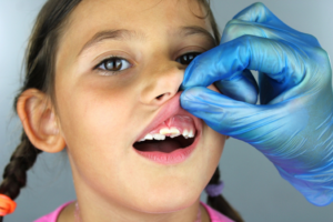 a child with shark teeth